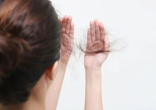 Understanding Hair Loss: Causes, Treatments, and Innovative Solutions in Dubai