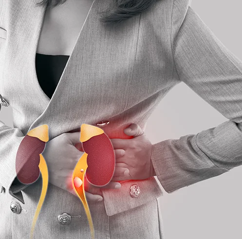 Kidney Profile Dubai
